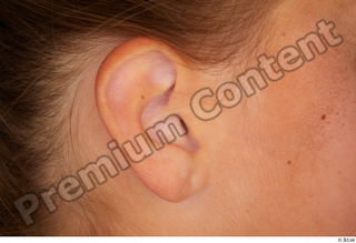 Esme ear 0002.jpg